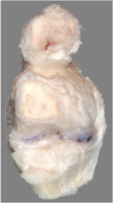<p>Describe the appearance of this specimen - are there any areas of obvious or specific abnormality?</p>