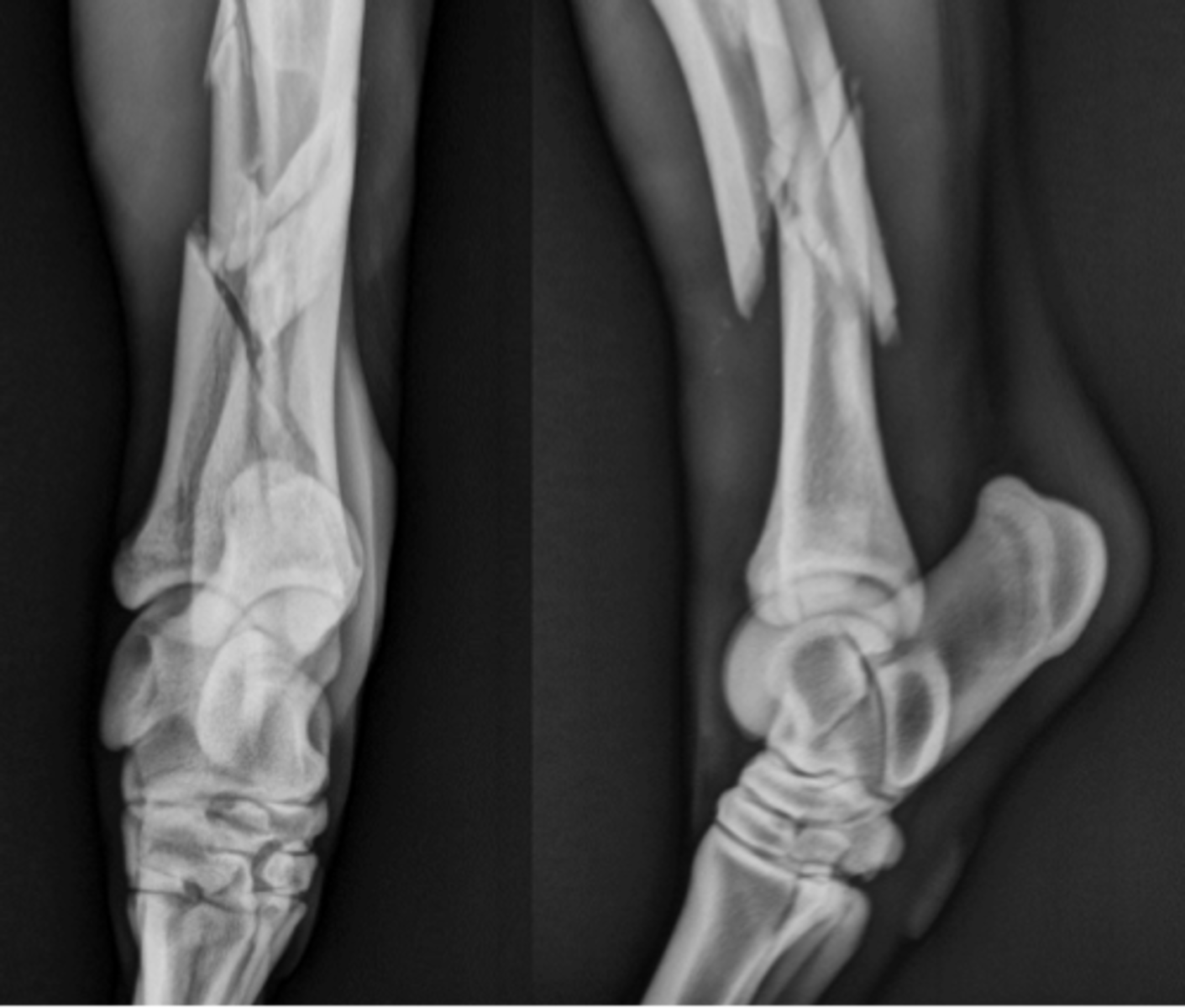 <p>How might you treat this fracture?</p>