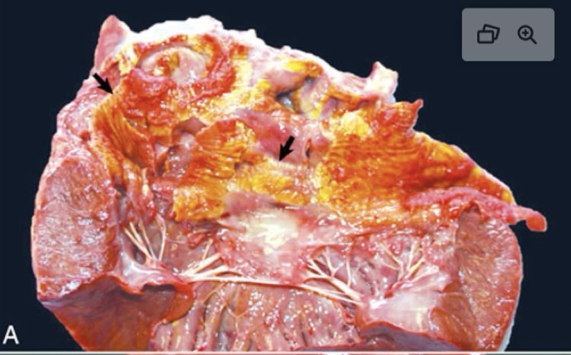 <p>what is this showing?</p>