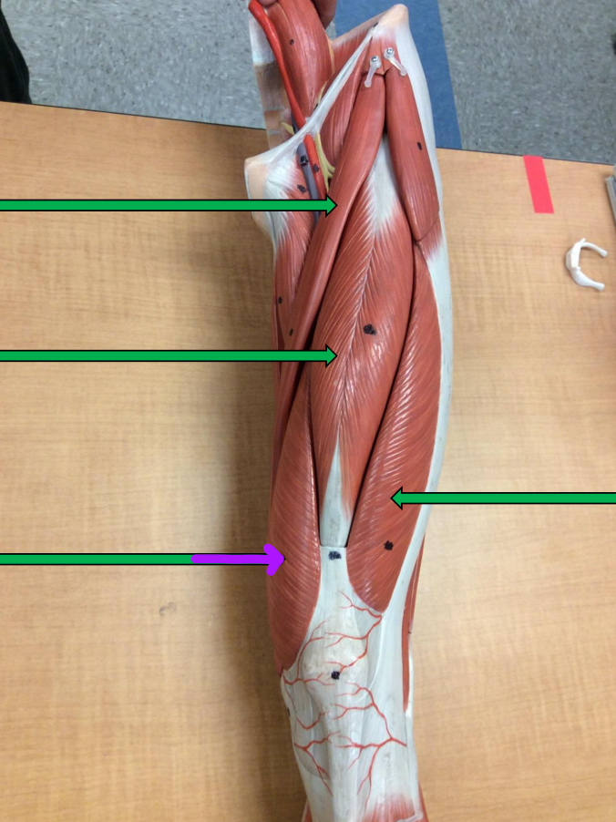 <p>Identify this muscle?</p>