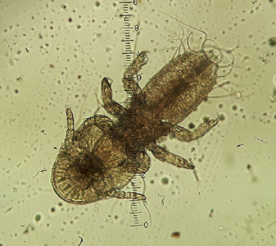 <p>1-4 mm</p>