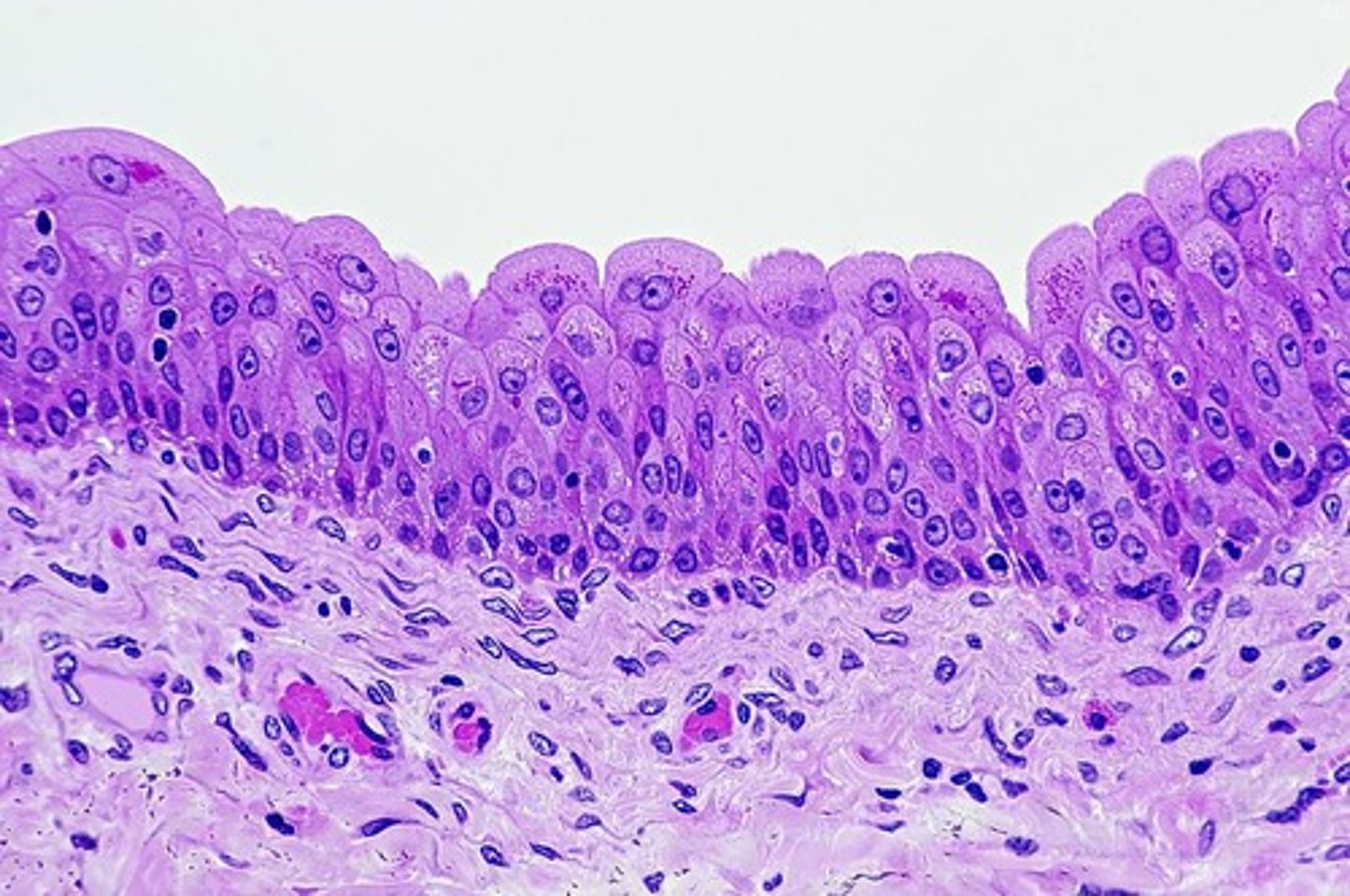 <p>A type of epithelium that can change shape, typically found in the bladder.</p>