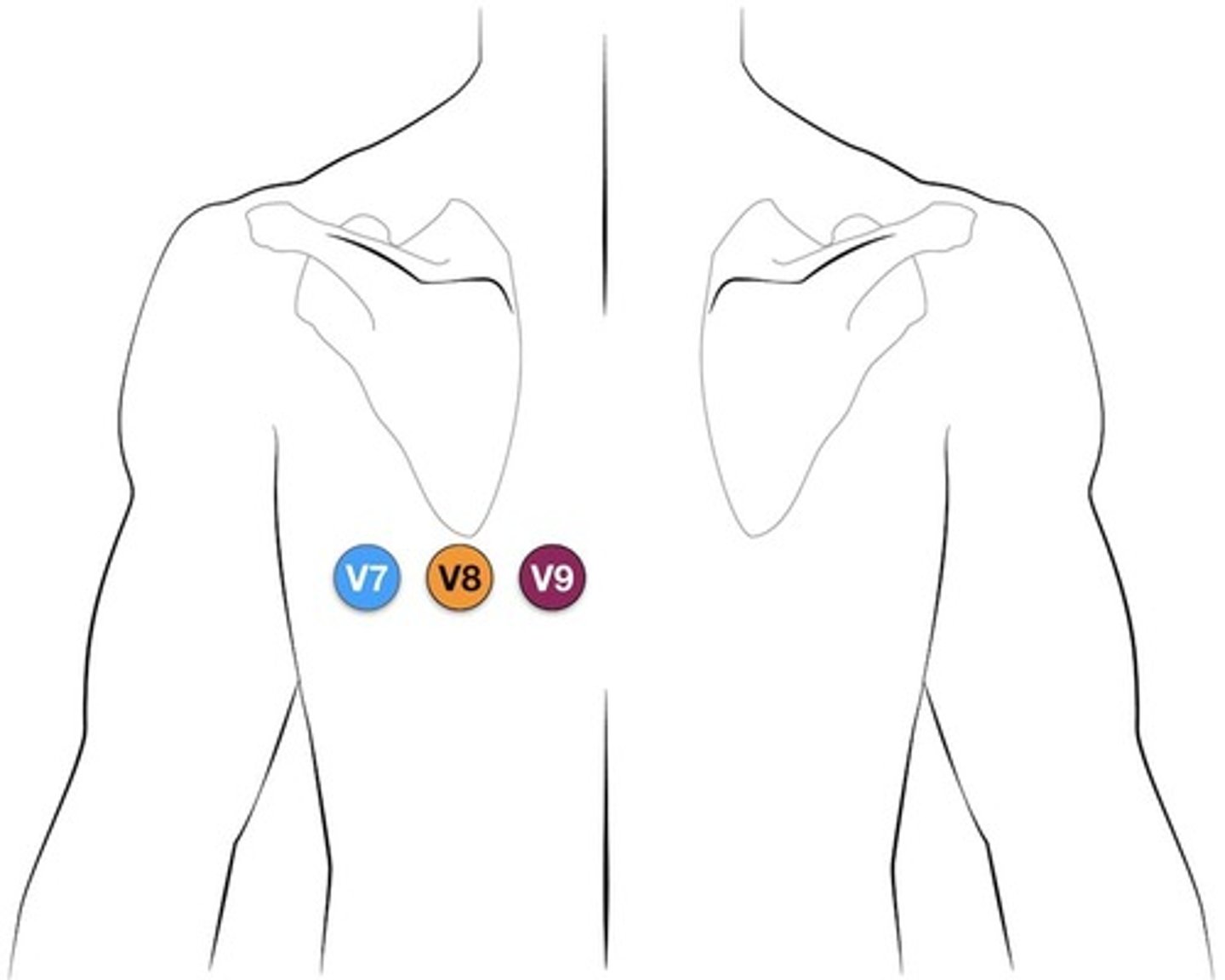 <p>left posterior axillary line</p>