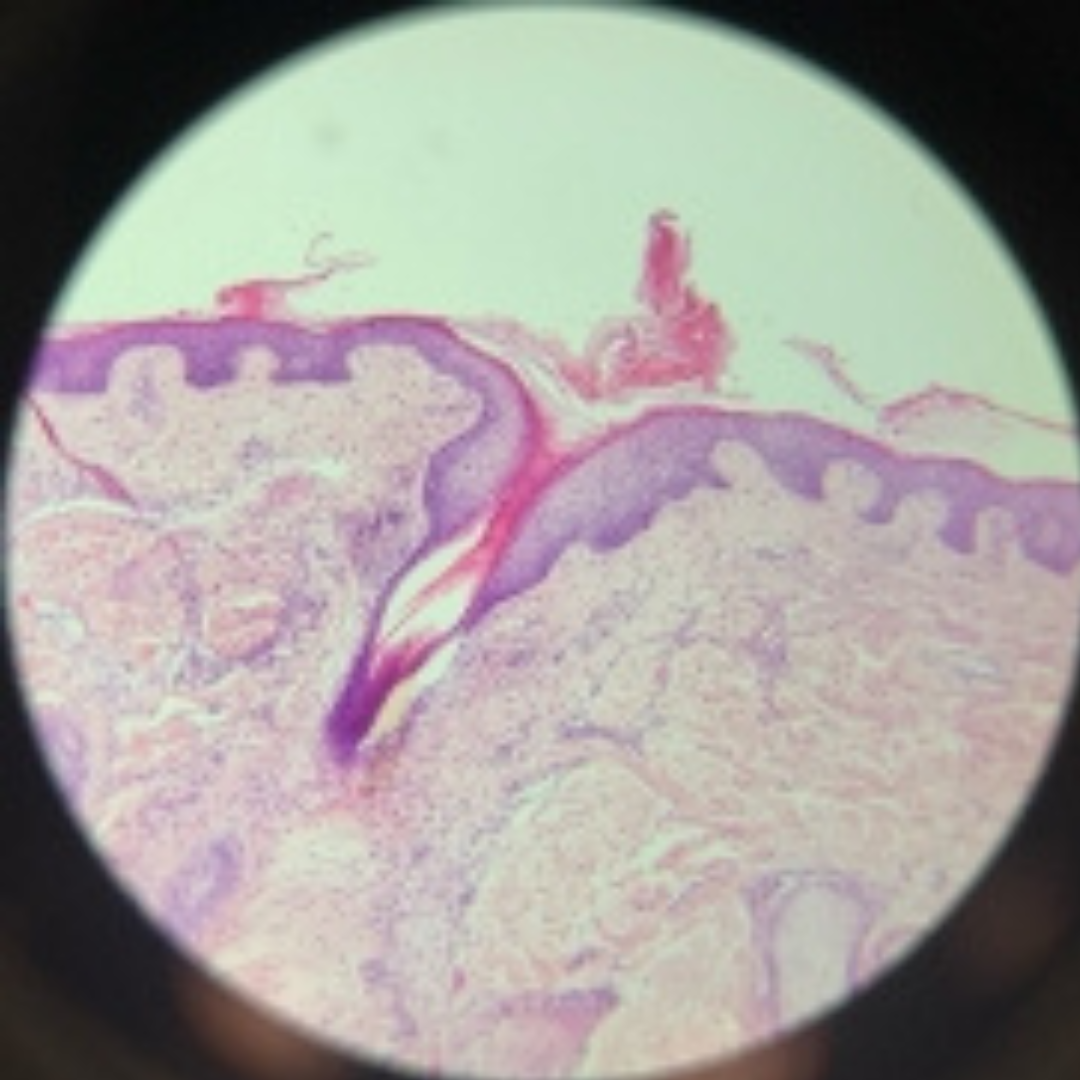 term image