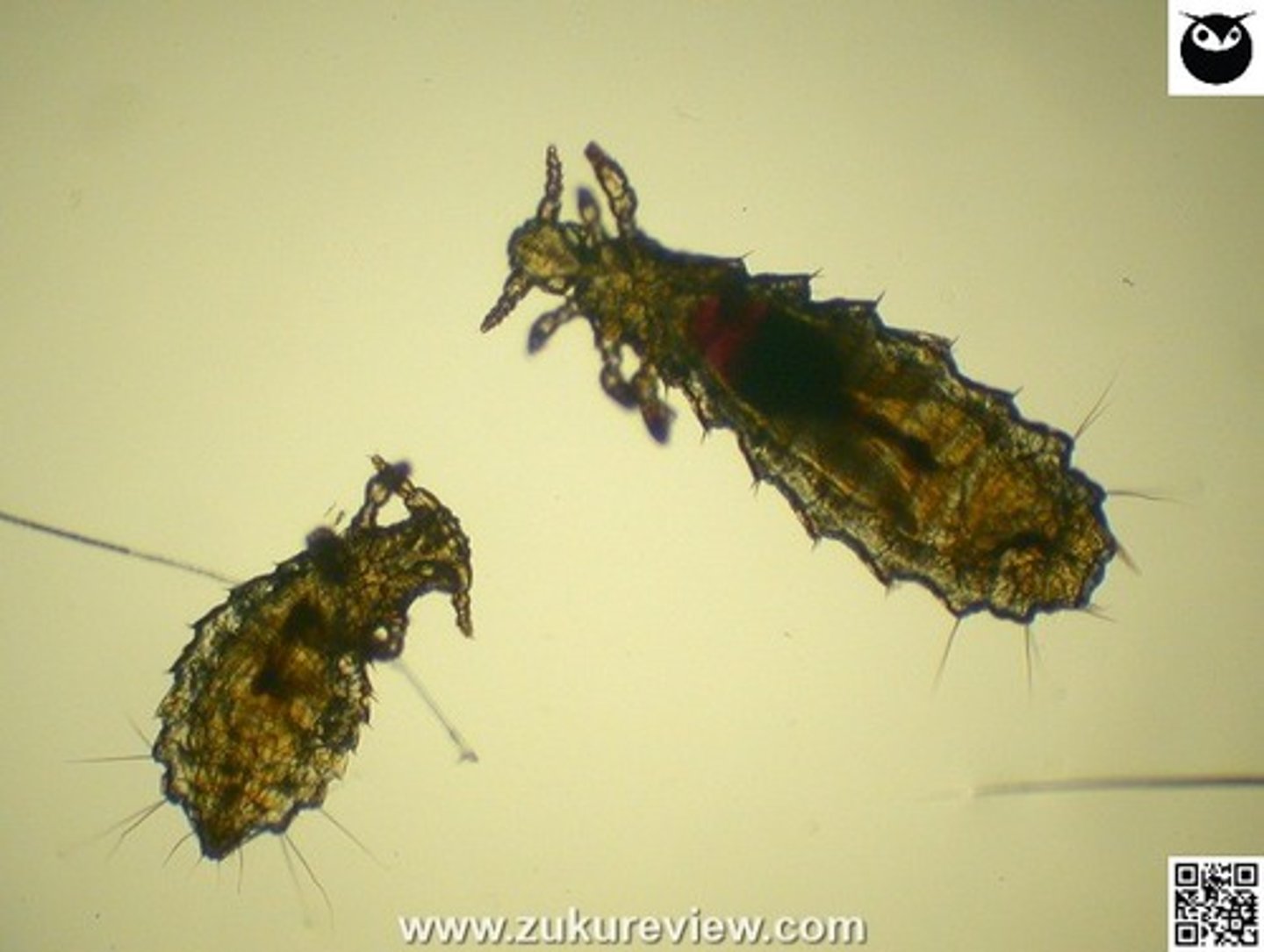 <p>A five-month-old male rat presents for lethargy and pruritus. There are a few excoriations and mild alopecia over the dorsum. Further examination detects small white speckles attached to the hairs.</p><p>Acetate tape imprints examined under the microscope reveal structures resembling eggs and a few parasites.</p><p>Which parasite has been found?</p><p>Demodicosis</p><p>Sucking louse</p><p>Fur mite</p><p>Sarcoptic mange</p><p>Cheyletiellosis</p>