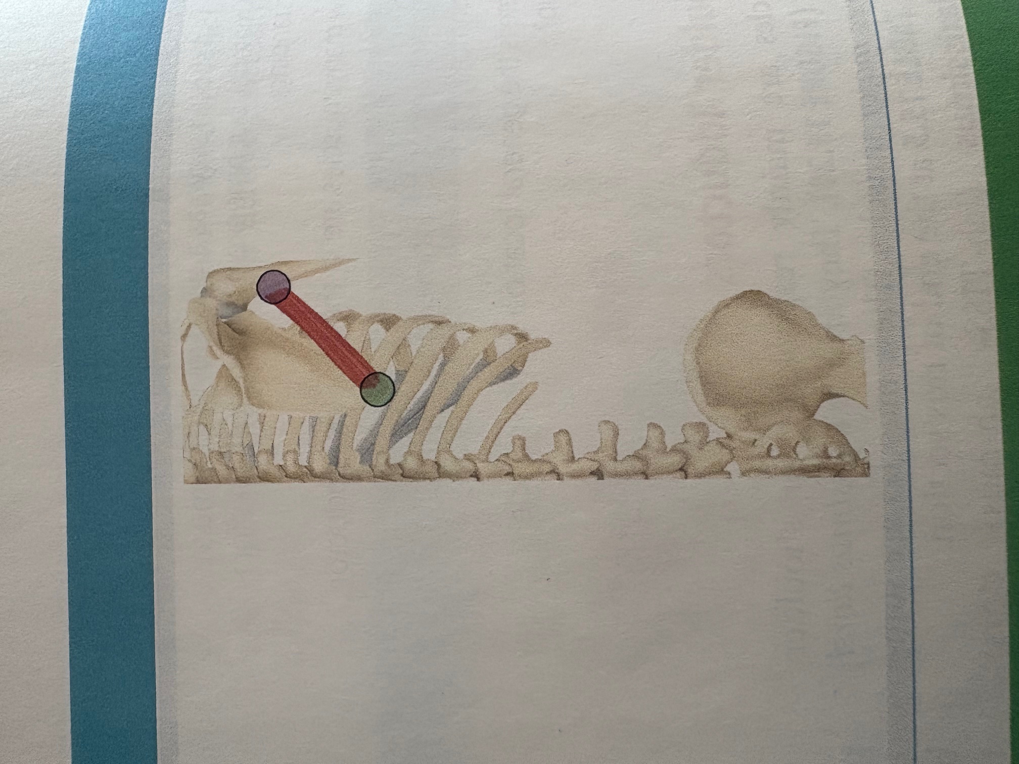 <p>Teres major</p>