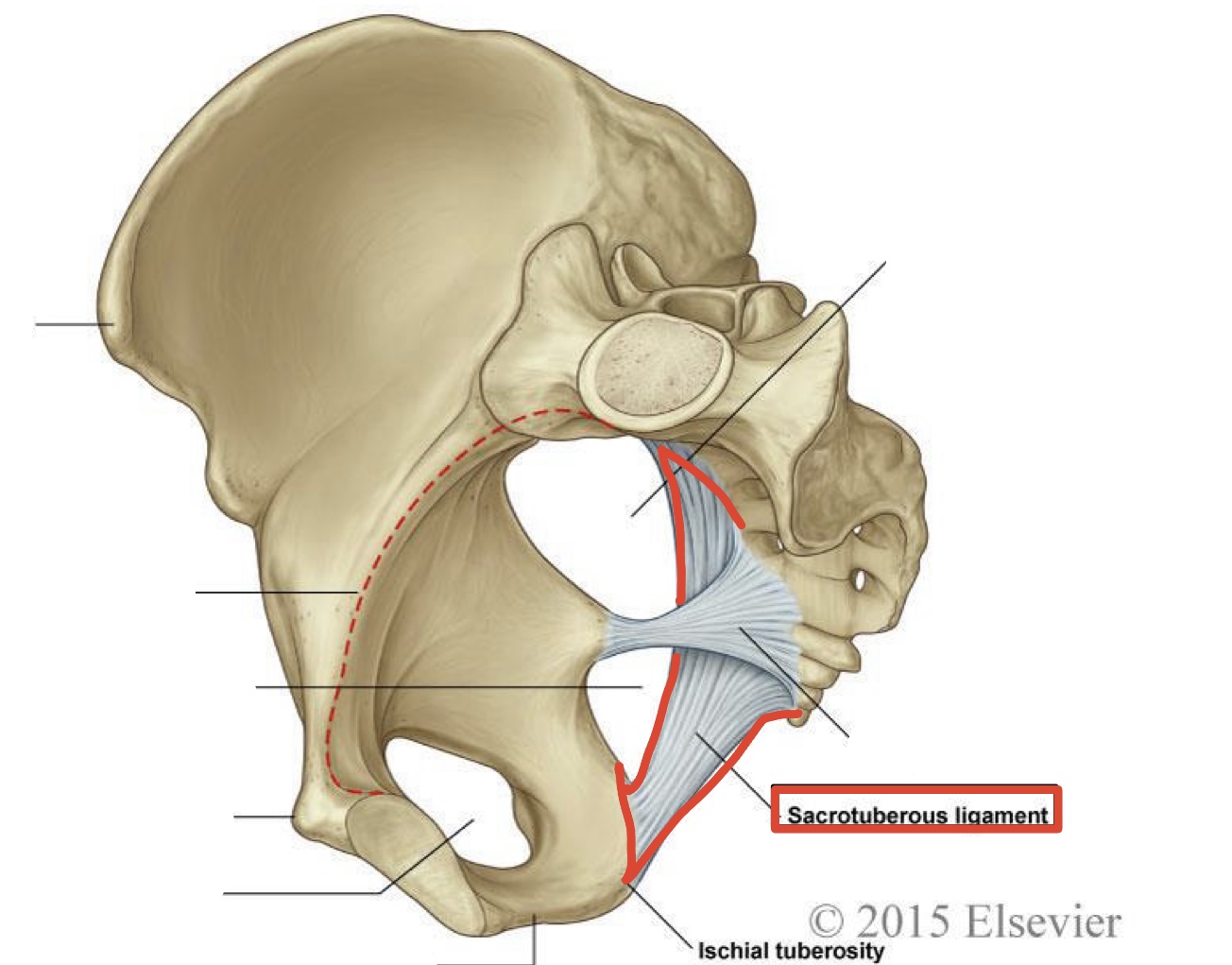 <p>Sacrotuberous Ligament</p>
