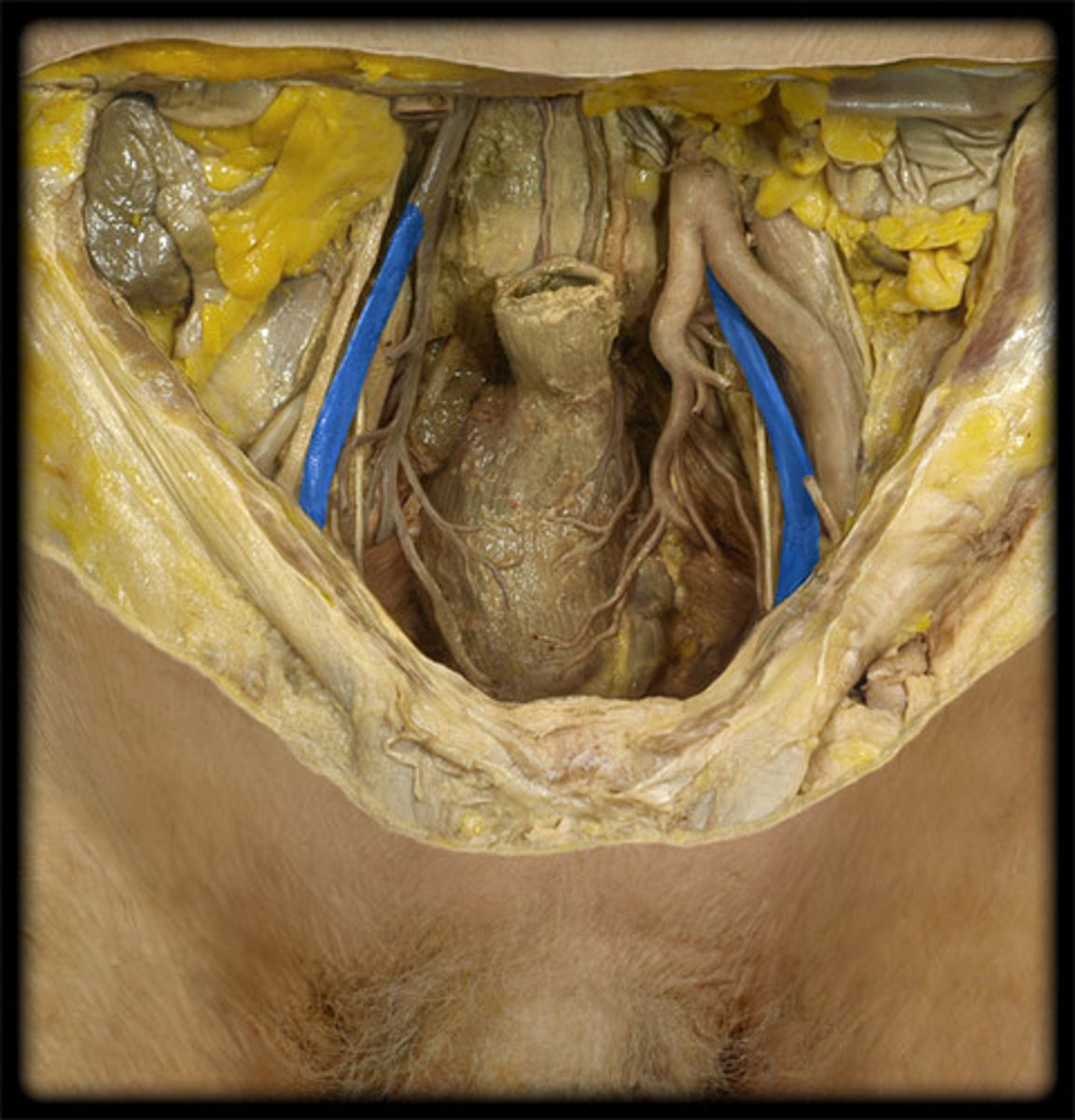 <p>-more lateral than internal iliac vein</p><p>-inferior to artery</p>