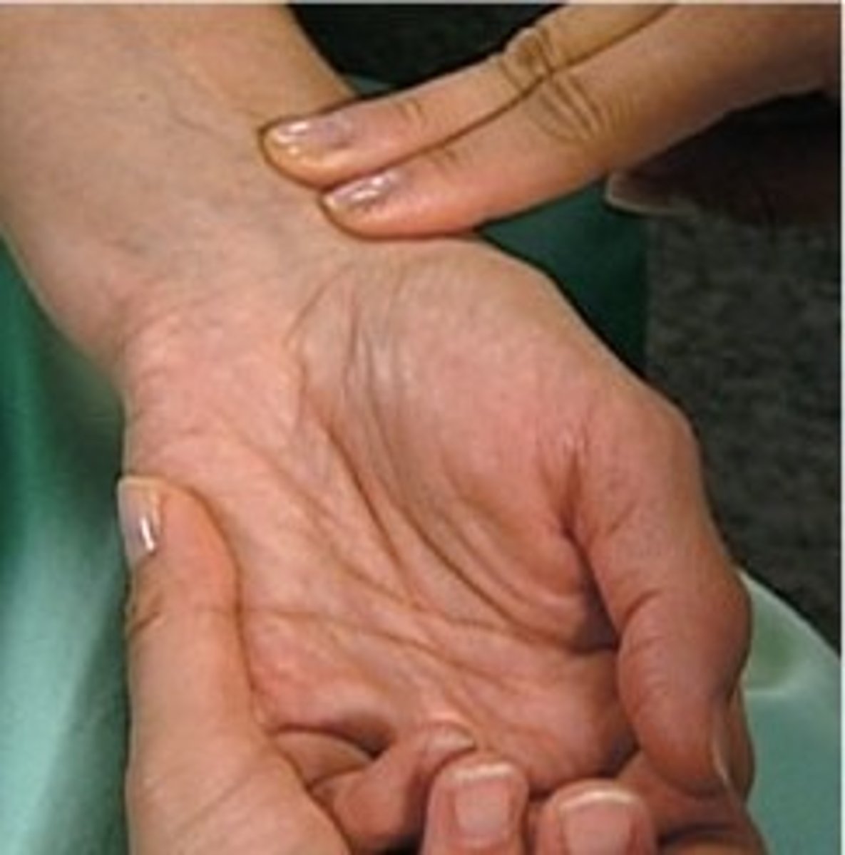 <p>Thumb side of the wrist, most typ adult site</p>