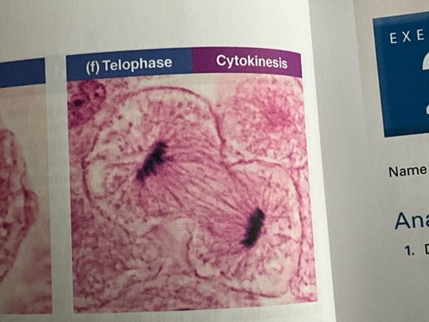 <p>Telophase</p>