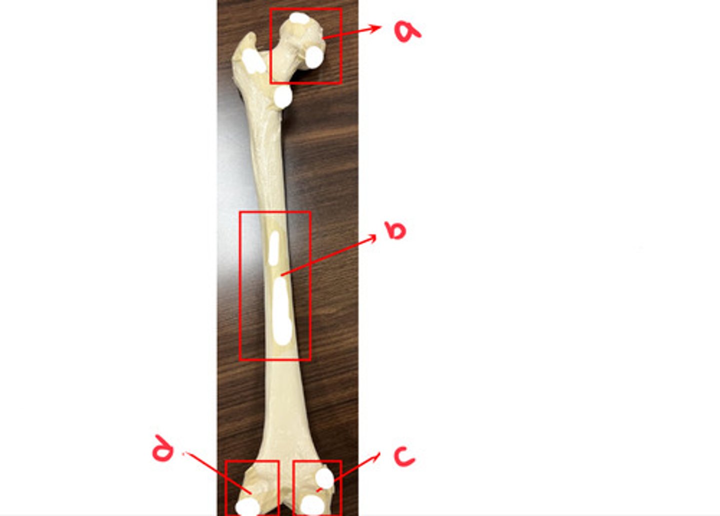<p>what structure is labeled by a?</p>
