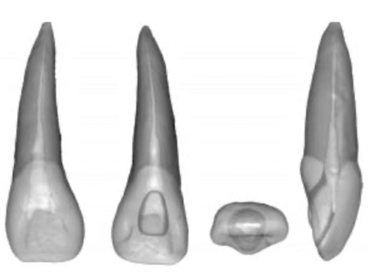 <p>maxillary central incisor</p>
