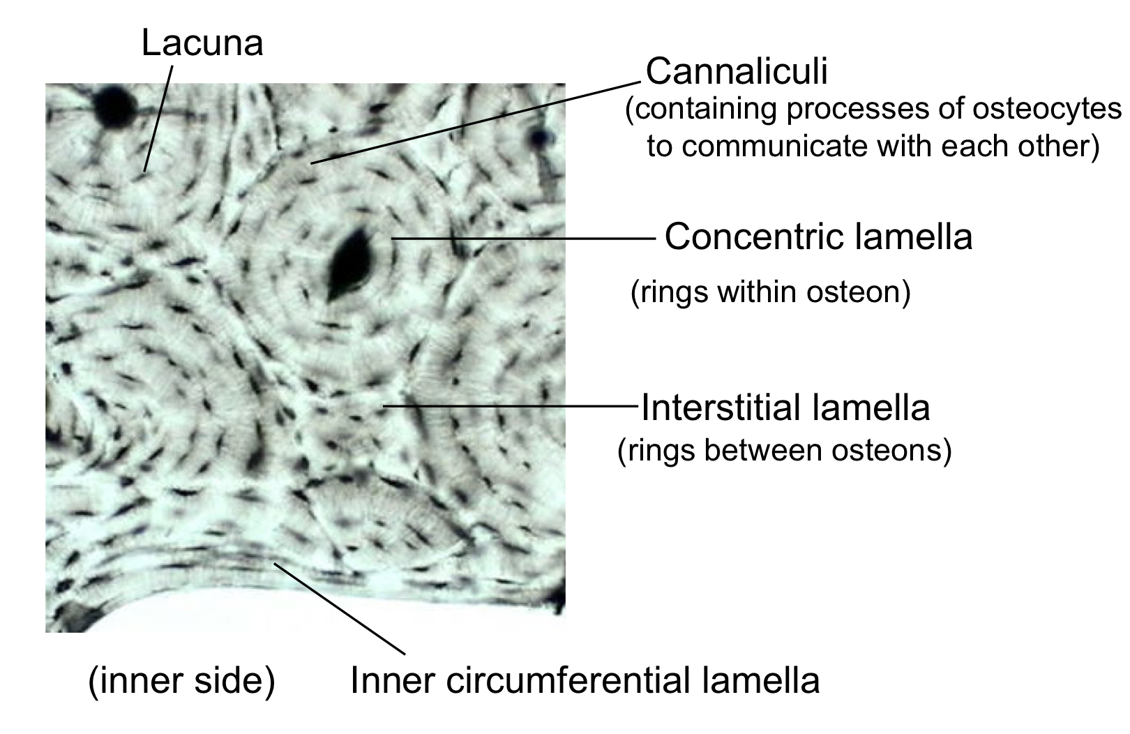 <p>what type of bone is this?</p>