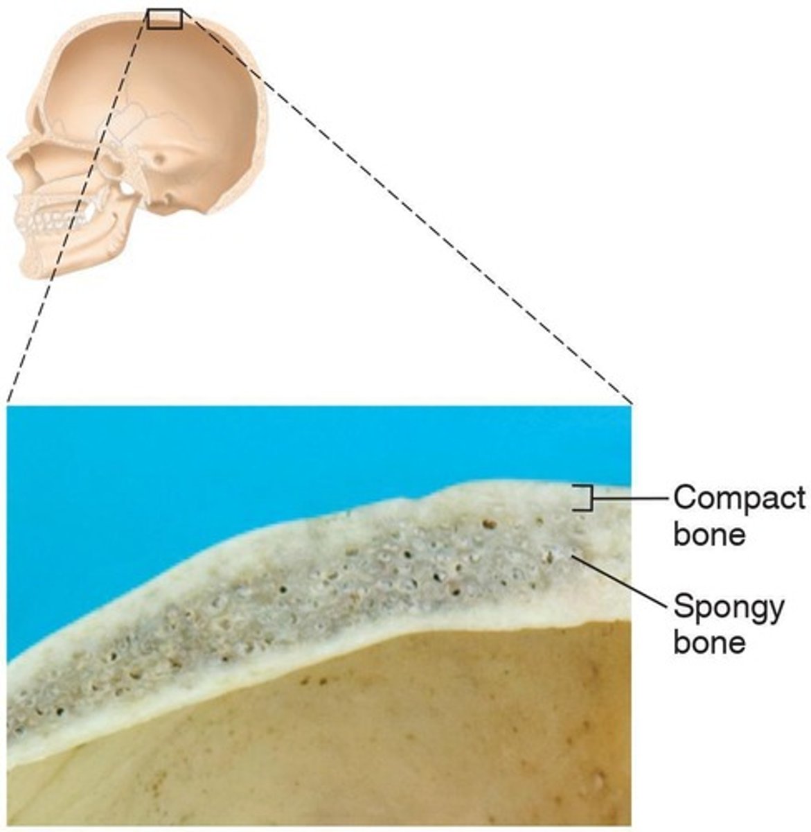 <p>Dense, smooth, and homogeneous type of osseous tissue.</p>