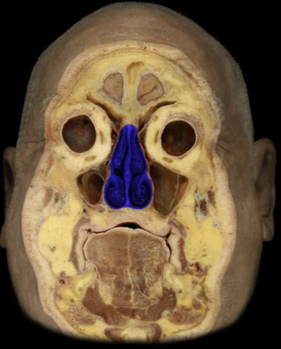 What structure is highlighted in blue?