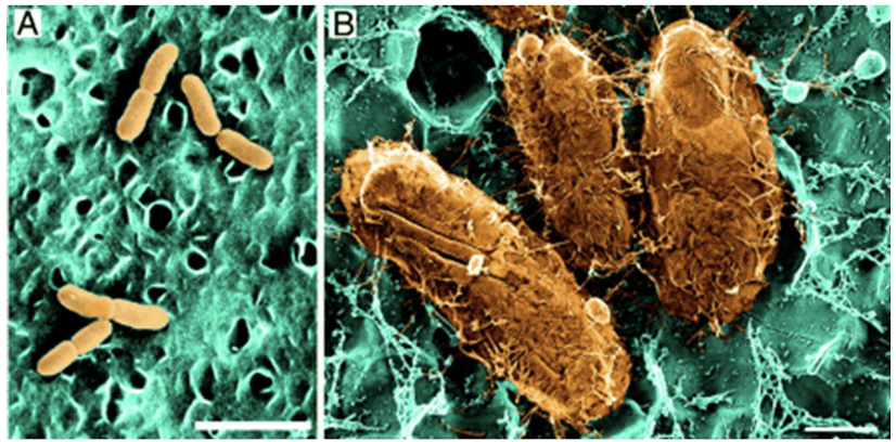 <ul><li><p>Uropathogenic E. coli (UPEC) is the main cause</p></li><li><p>~150 million cases of UTIs annually</p></li><li><p>Can cause inflammation and long-term damage despite treatments</p></li></ul><p></p>