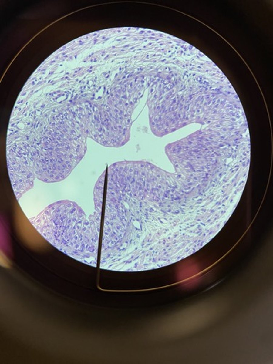 <p>urinary bladder</p>