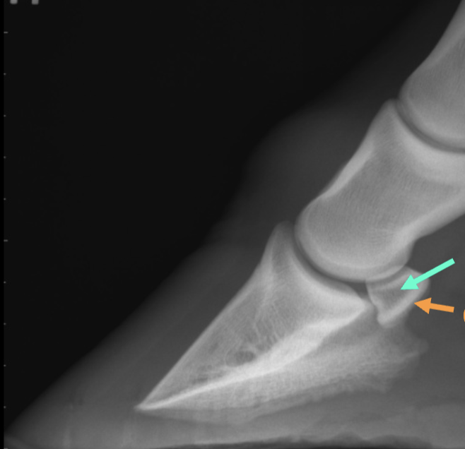 <p>what is the teal arrow</p>