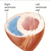 ***Comparison of Right & Left Pumps***

\
**→ Pulmonary circuit (right side)** is low-pressure, low-resistance as it only pumps blood to lungs

\
**→ Systemic circuit (left side)** is a high-pressure, high-resistance as it must move through the entire body. This is achieved by this left side containing more muscle to pump blood throughout
