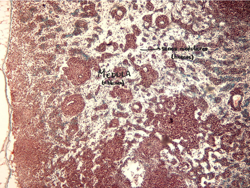 <p>Ganglio linfático</p><p>fibras reticulares del estroma - verde</p>