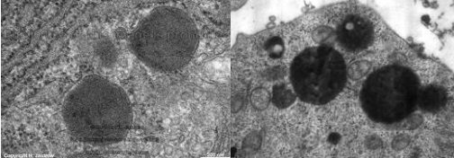 <p>Lysosomes are </p>