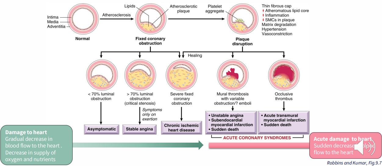 <p>- damage to heart: gradual decrease in blood flow to the heart. Decrease in supply of oxygen and nutrients</p><p>- acute damage to heart: suden increase in blood flow to the heart</p><p>.</p><p>- diagram important to understand</p>