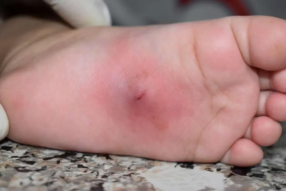 <p>bị nhiễm </p><p>The plant is infected with a fungus.</p>