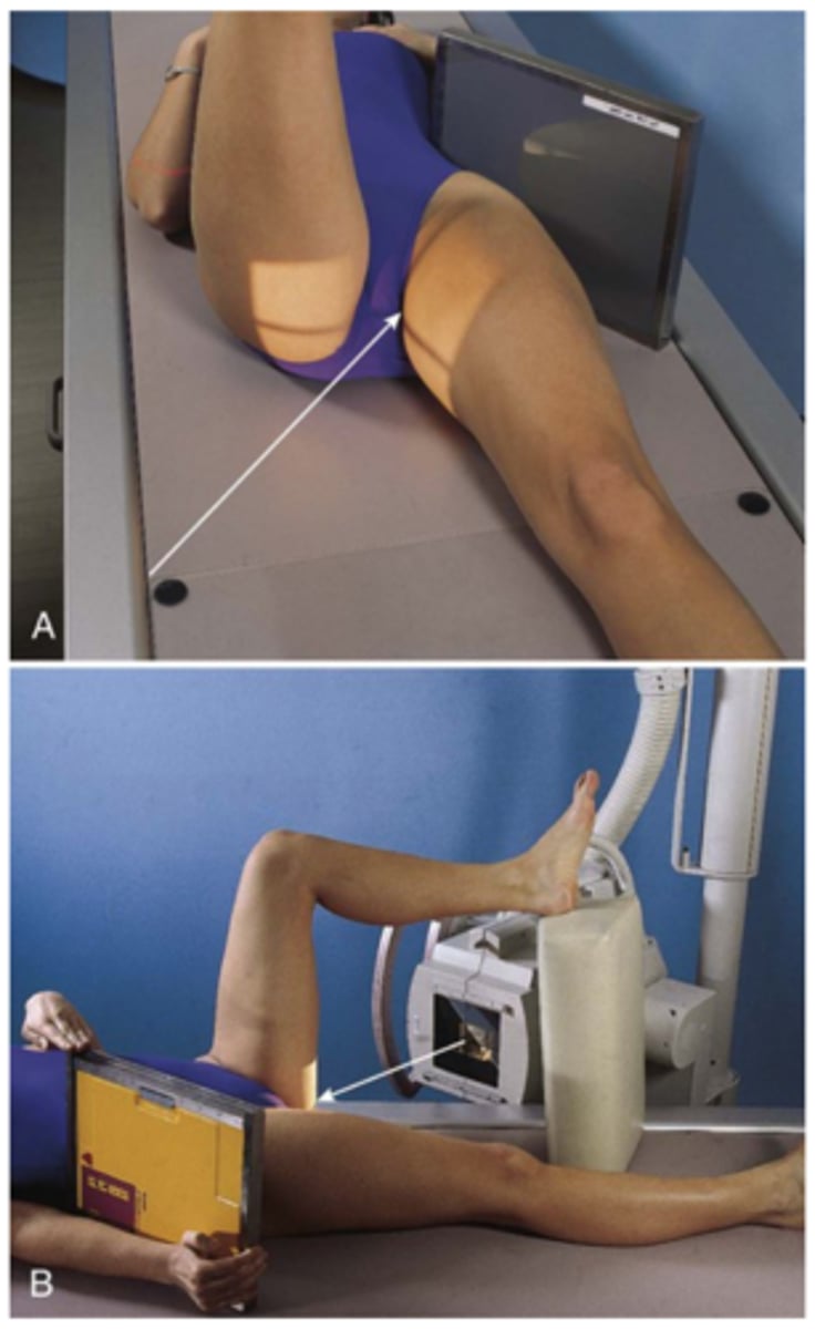 <p>horizontal and perpendicular to femoral neck and IR</p>