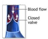 <ol><li><p>Does this vein look normal or abnormal? </p></li><li><p>If abnormal, what pathology would it be? </p></li></ol><p></p>