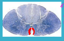 <p>in the medial and anterior portions </p>