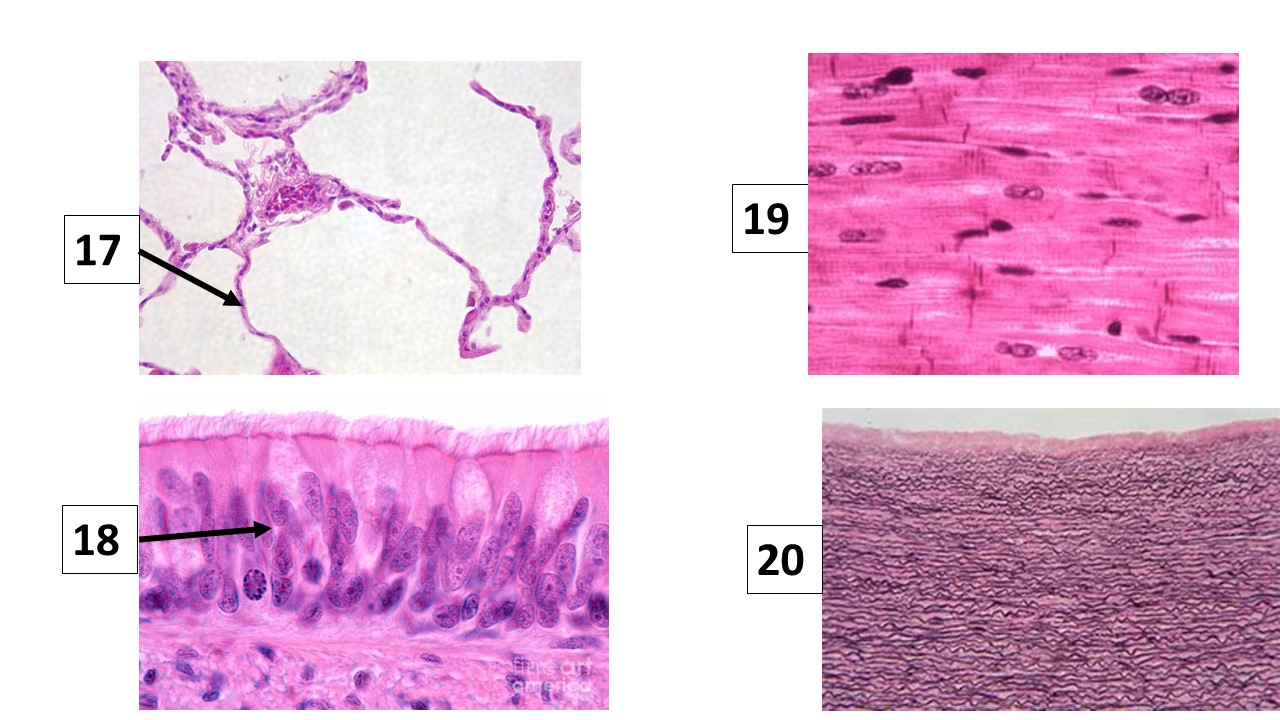 <p>Identify tissue #17</p>