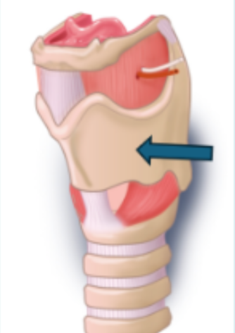 <p>What is the name of the structure at the tip of the arrow?</p>