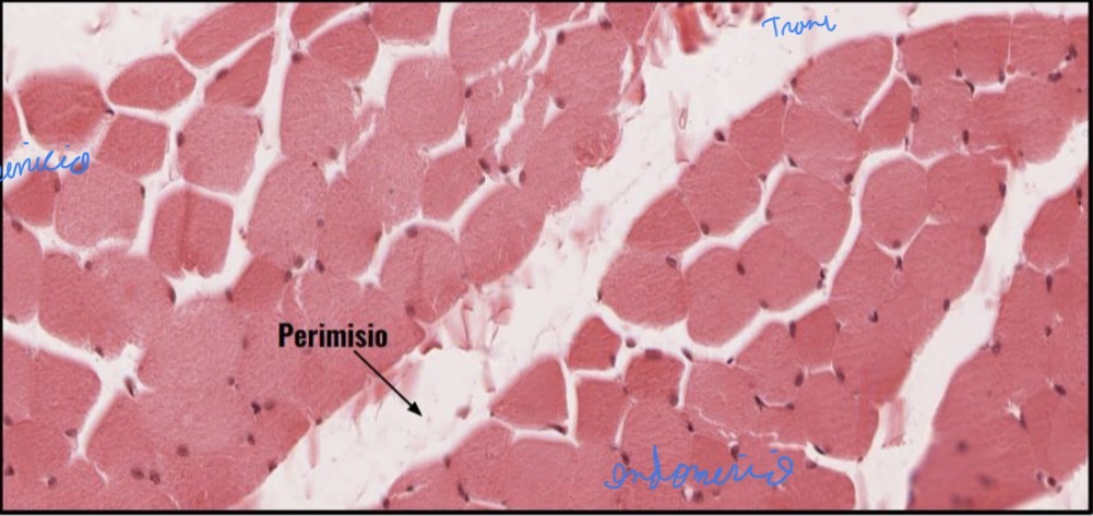 <p>Tejido muscular esquelético corte transversal</p>