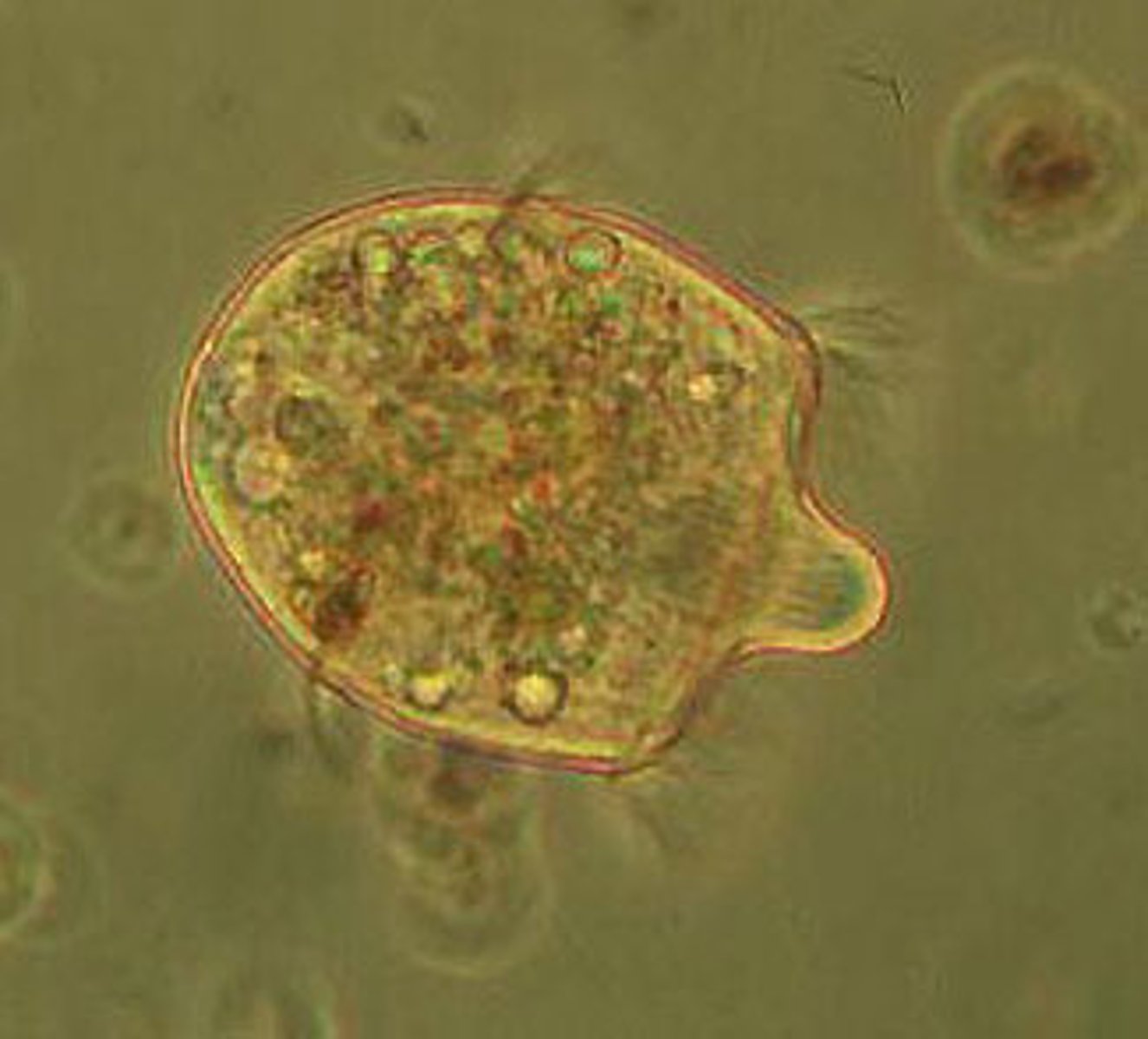 <p>Contain sac-like vesicles called alveoli, dinoflagellates, stentor and paramecium</p>