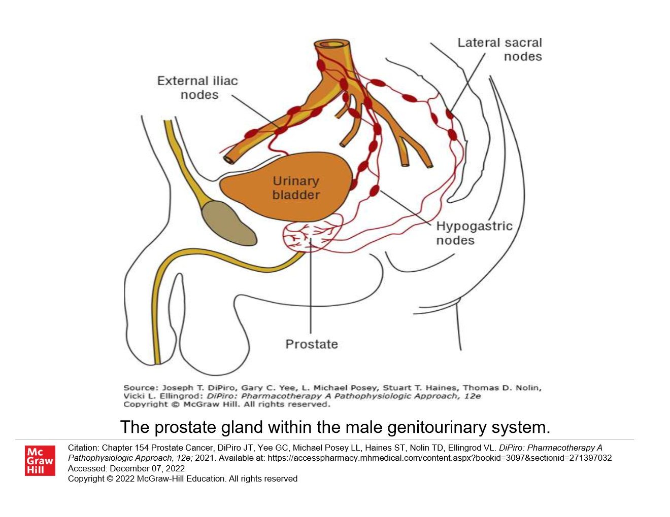 <p>What are probable risk factors for prostate cancer?</p>