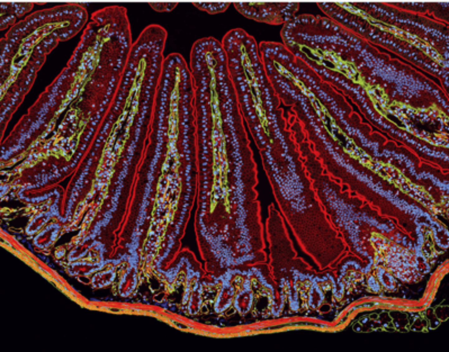 <p>in the smooth muscle that surrounds the intestine (bottom)</p>