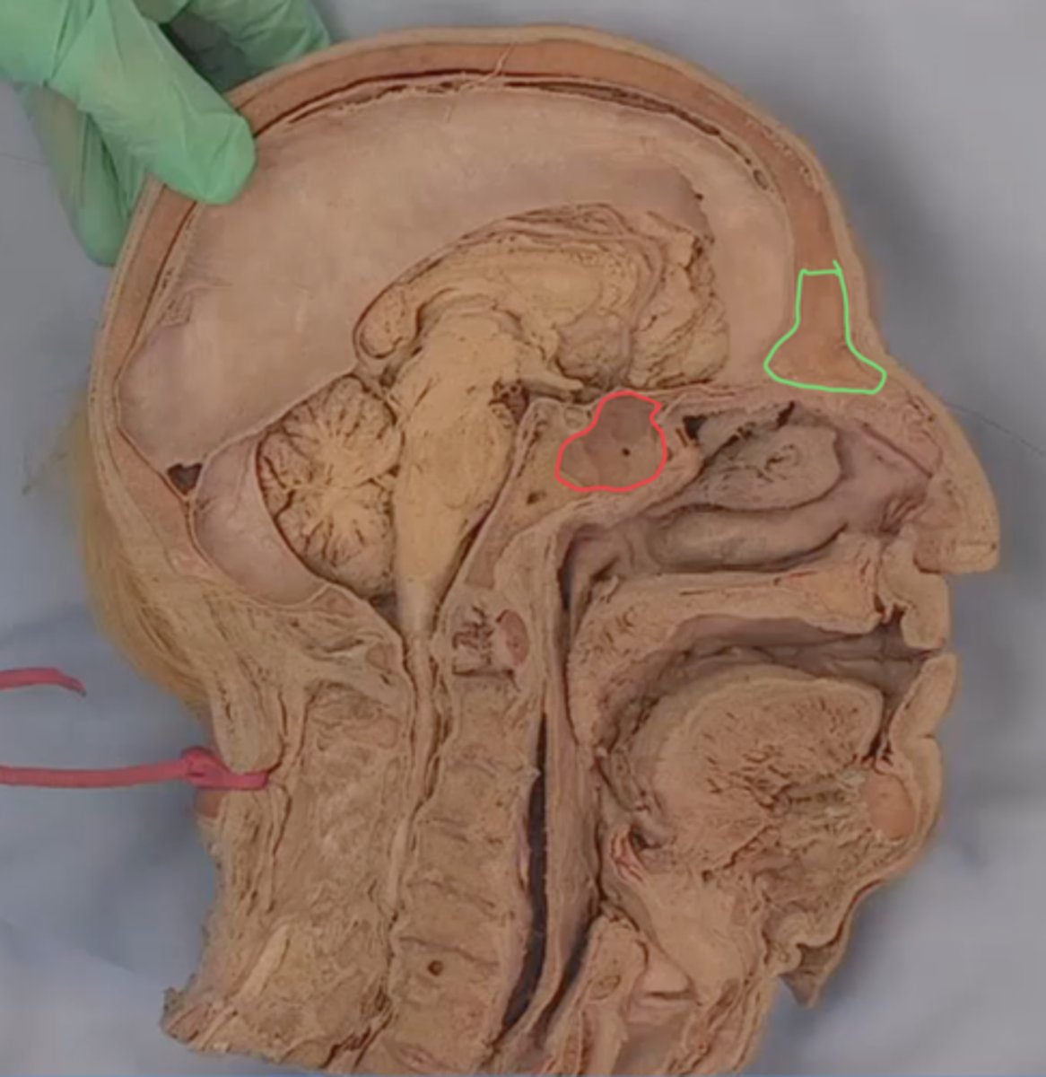 <p>identify structure outlined in green</p>