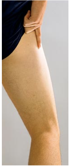 Thick band of connective tissue

Insertion of tensor fasciae latae and gluteus maximus

Passes across greater trochanter of the femur as the hip joint flexes and extends

Trochanerica burs finish latera 