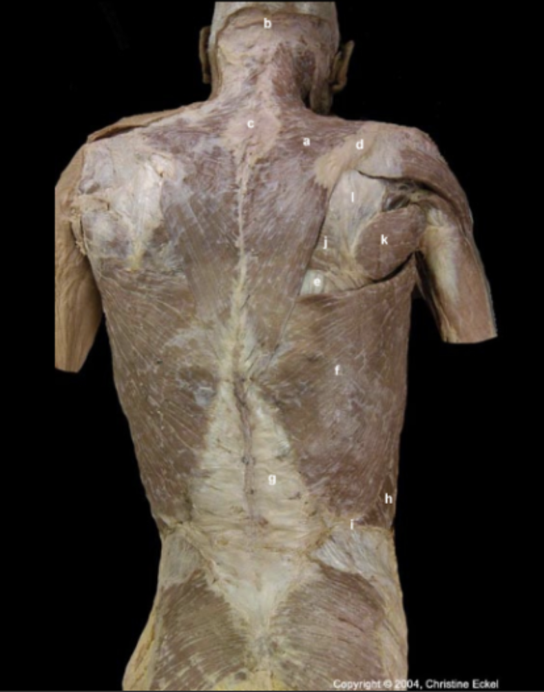 <p>Identify the Extrinsic Muscles of the Back</p>
