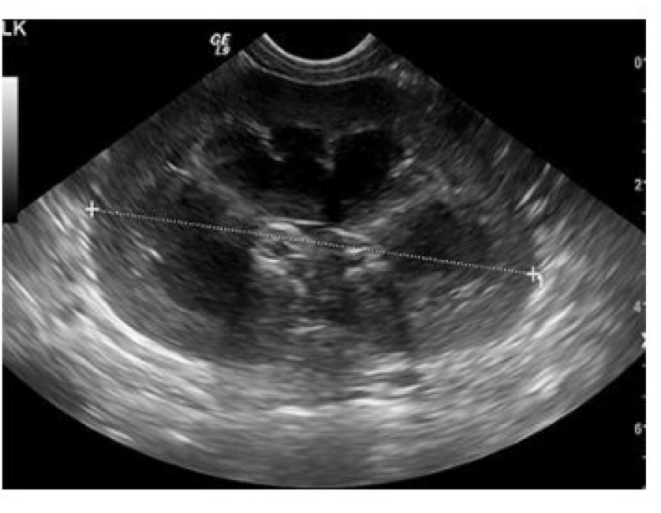 <p>Is this short axis or long axis view of the kidney?</p>