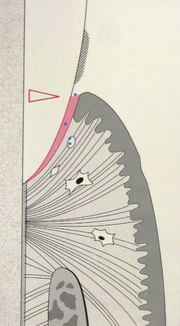 <ul><li><p>Few mainly G+ aerobic bacteria</p></li><li><p>Normal junctional epithelium</p></li><li><p>A few PMNs (WBCs) with very little crevicular exudate</p></li><li><p>Connective tissue WNL</p></li><li><p>Alveolar bone WNL</p></li></ul><p></p>