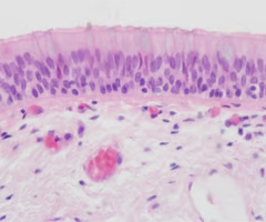 <p>two or more layers of column like cells</p><ul><li><p><strong>protection and secretion</strong></p></li><li><p>rare in the body; small amounts in <strong>male urethra</strong> and in large ducts of some glands (salivary esophageal)</p></li></ul><p></p>