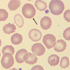 <p>What characteristic describes the size of this erythrocyte?</p>
