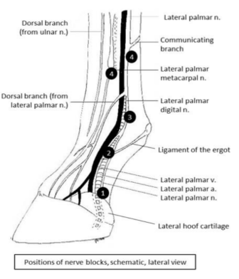 <p>4 distinct targets of nerve blocks</p><p></p>