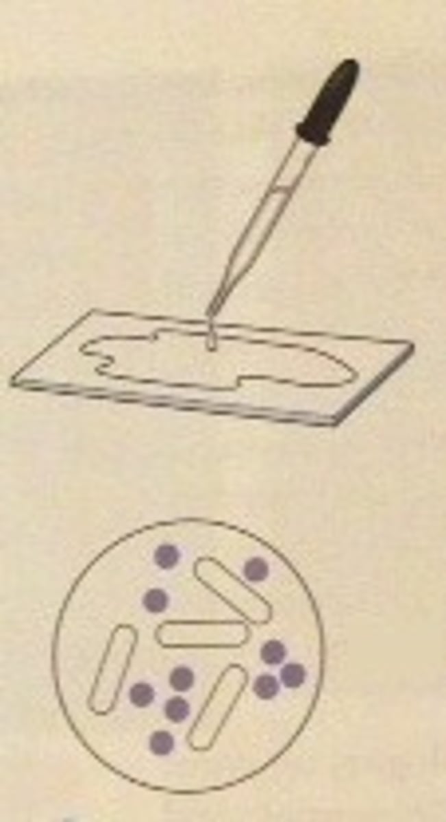 <p>decolorizer in gram stain</p>
