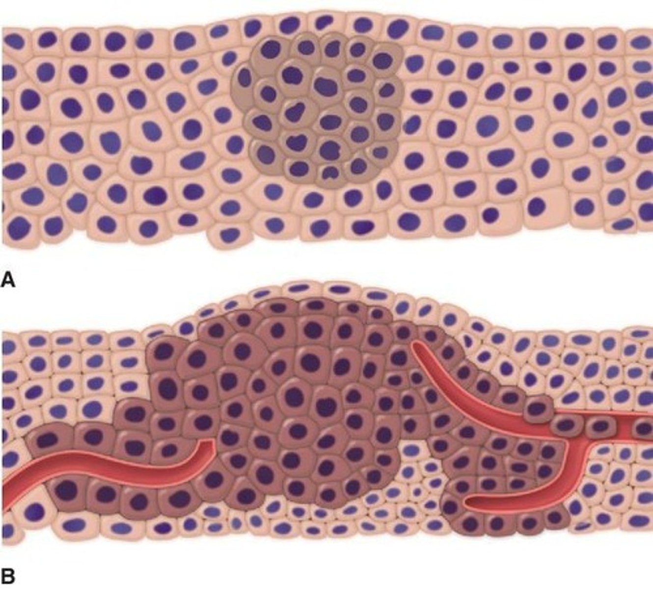 <p>The process of creating a new vascular flow to establish a nutrient network at distant tissues.</p>