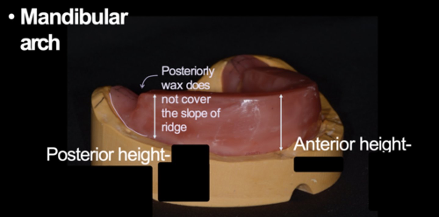 <p>What is the anterior height from the top to the vestibule in the mandibular arch?</p>