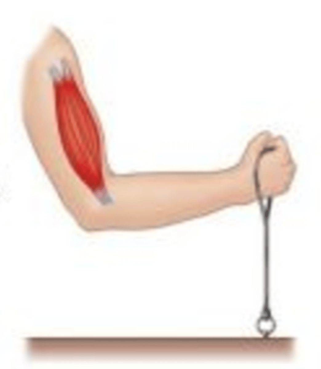 <p>A static contraction in which muscle tension is generated but the myofilaments are NOT able to slide past one another; as a result the body does not move</p>