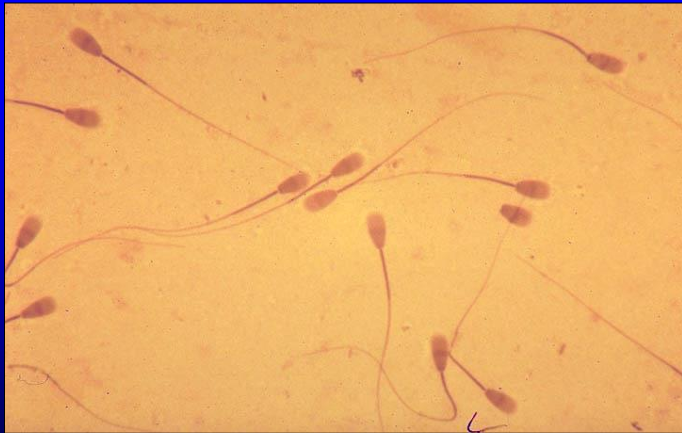 <p>Identify the structure:</p><p>Specie:</p><p></p>