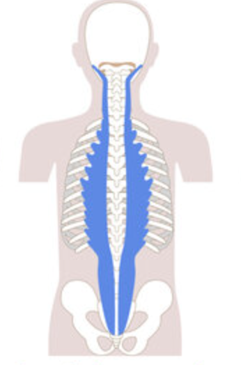 <p>Origin: Tp of cervical, thoracic, and lumbar vertebrae</p><p>Insertion: mastoid process, TP of cervical and thoracic vertebrae</p><p>Action: (bilaterally) extension. (unilaterally) lateral flexion</p>